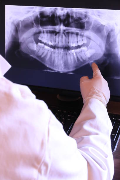 Best Emergency Root Canal Treatment in Burnet, TX