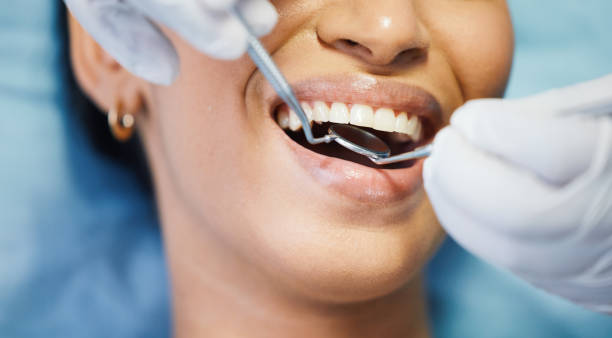 Best Emergency Broken Tooth Repair in Burnet, TX